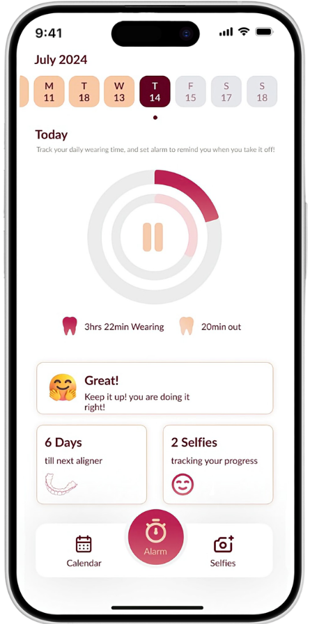 Receive reminder to change your aligner