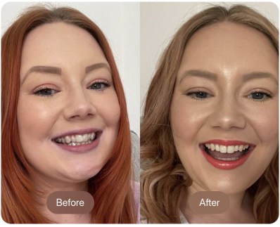 Before and after - red-haired woman