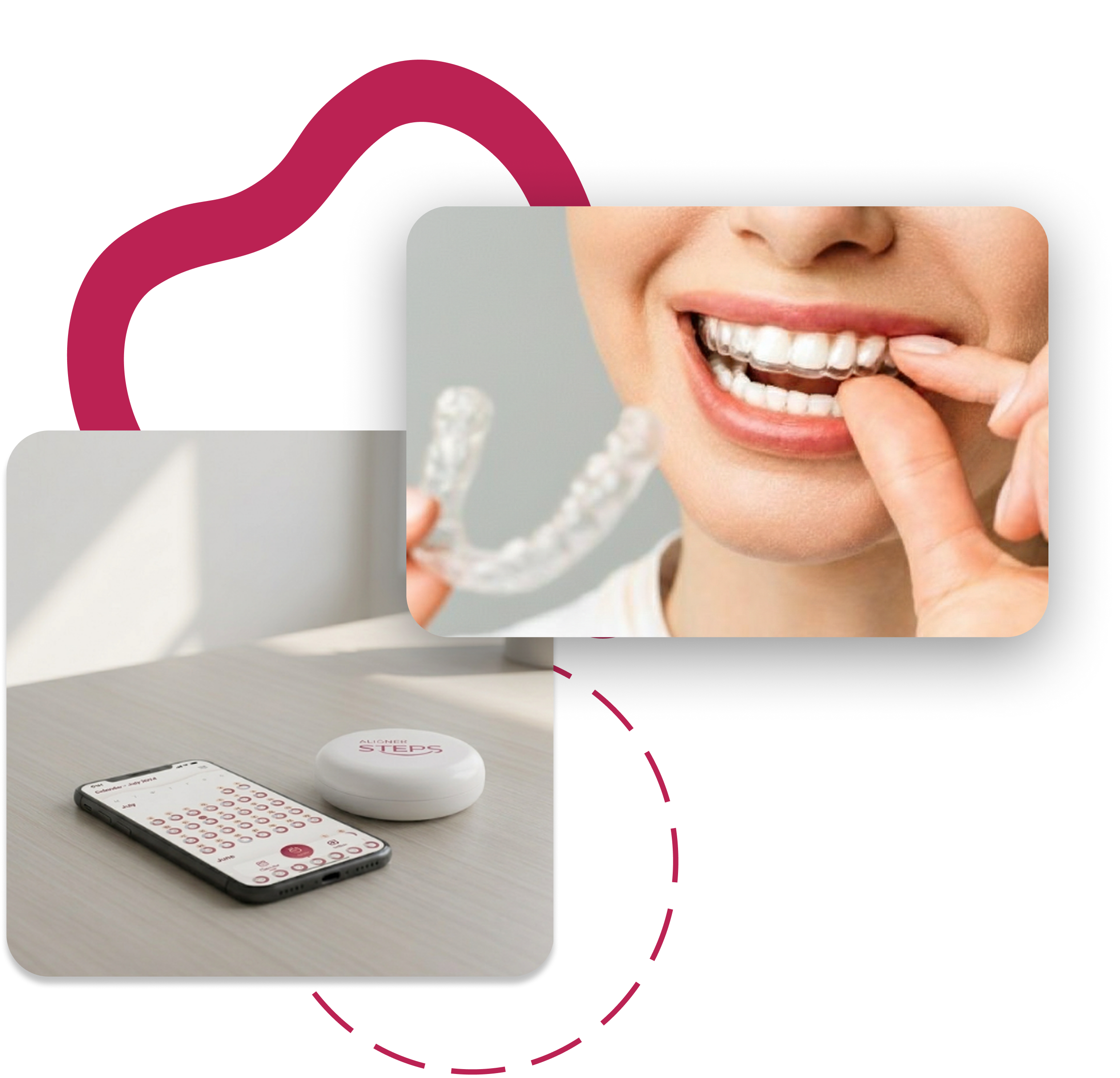 Composite showing aligner usage and remote monitoring